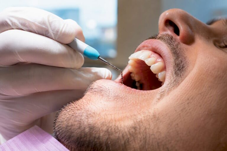 How Probing Depth and CAL Decide Your Periodontal Stage